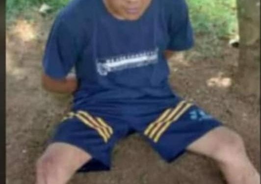 KESURUPAN TEGA PENGGAL KEPALA BAPAK