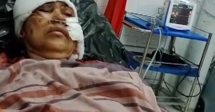 “Tinumbu Berdarah” Anak Perempuan Parangi Ibunya Di Kota Makassar