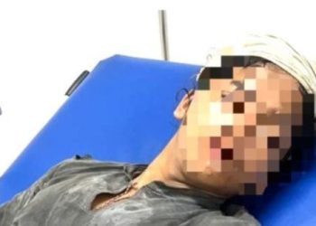Warga Baduy Dibegal Brutal di Jakarta, Dagangan Ludes dan Lengan Terluka!