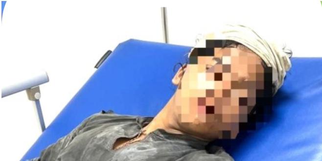 Warga Baduy Dibegal Brutal di Jakarta, Dagangan Ludes dan Lengan Terluka!