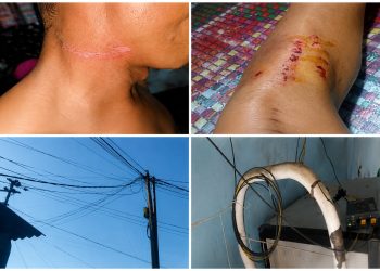 Leher Pengendara Tersangkut Kabel Internet Diduga Menjuntai, Warga Malingping Terluka; Penyedia Jaringan Terancam Dilaporkan ke Polisi